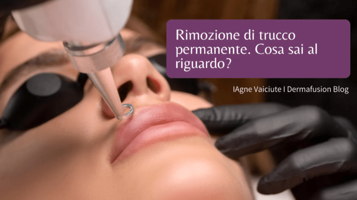 Cosa sai riguardo alla rimozione dei tatuaggi e trucco permanente? - Dermafusion