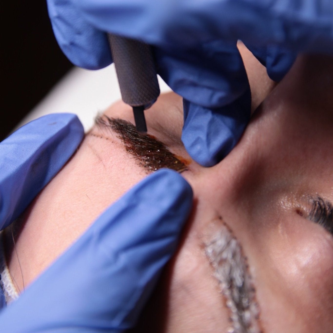 Consulenza prima del trattamento - Dermafusion