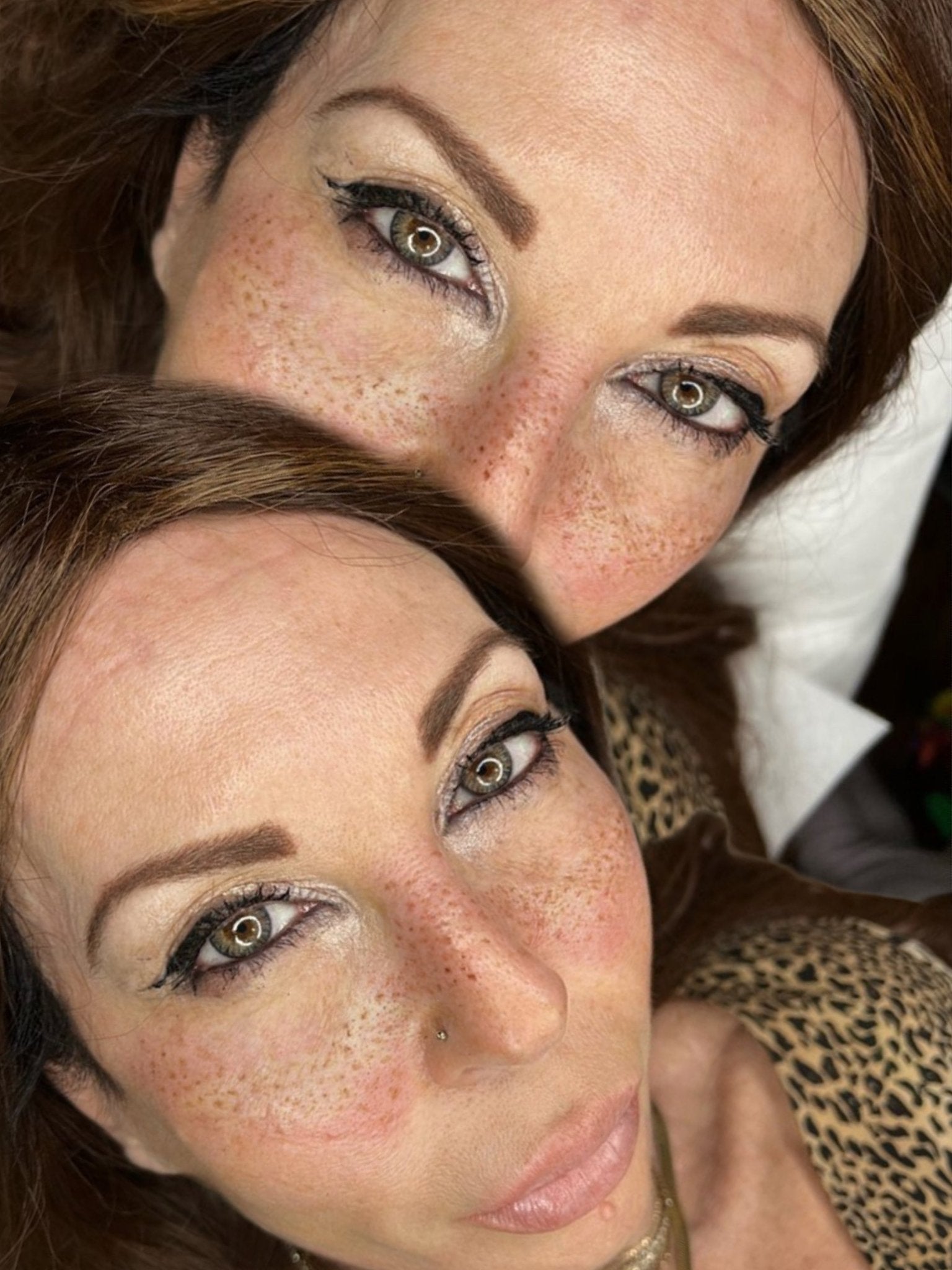 Corso online lentiggini tatuate "Foxy Freckles" - Dermafusion