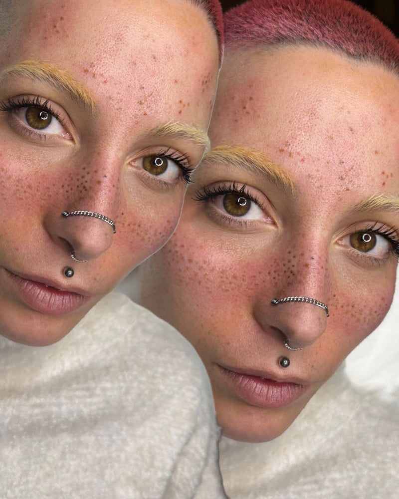 Corso online lentiggini tatuate "Foxy Freckles" - Dermafusion