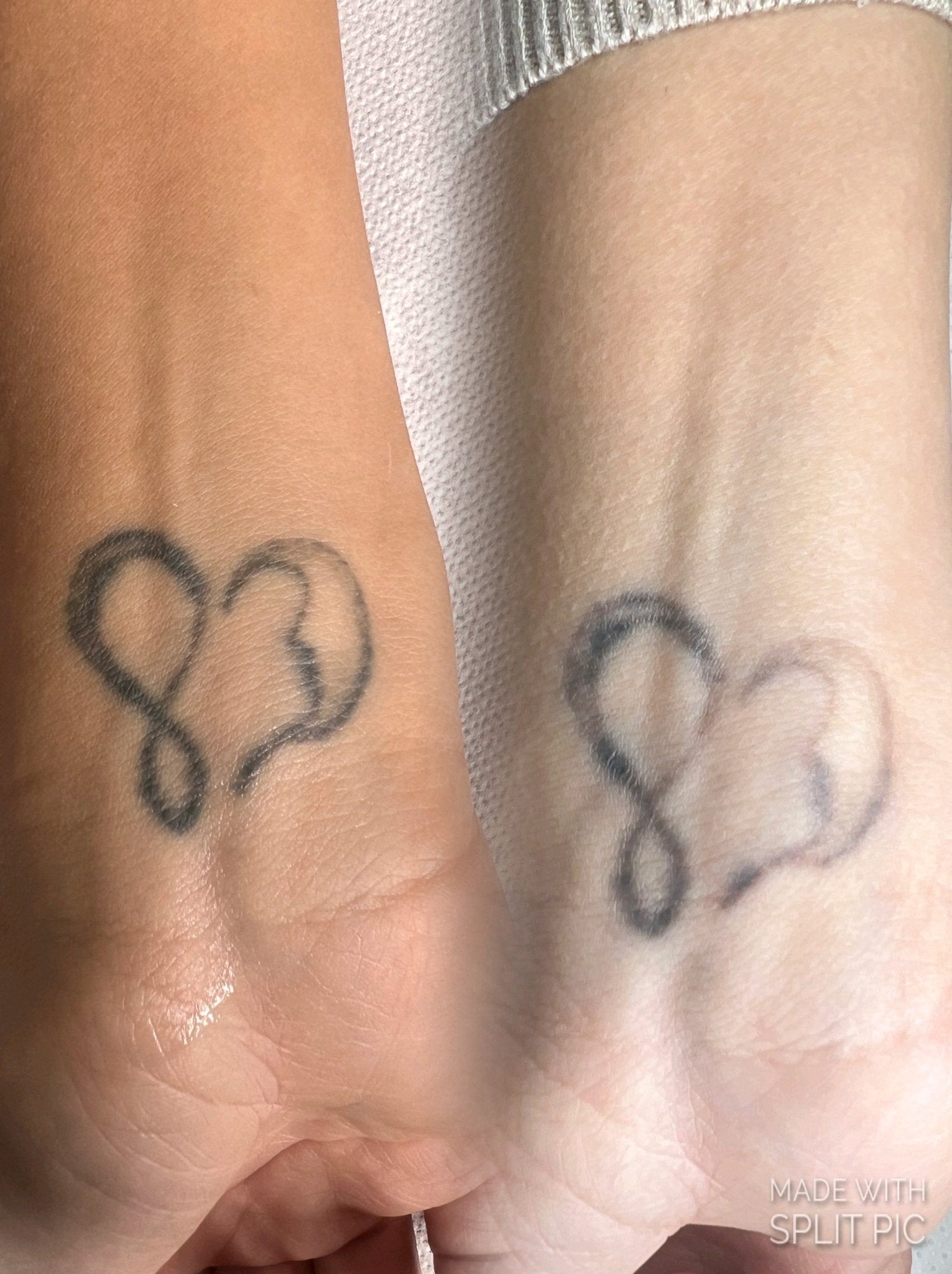 Corso online "Rimozione Trucco Permanente e Body Tattoo" KIT COMPRESO - Dermafusion