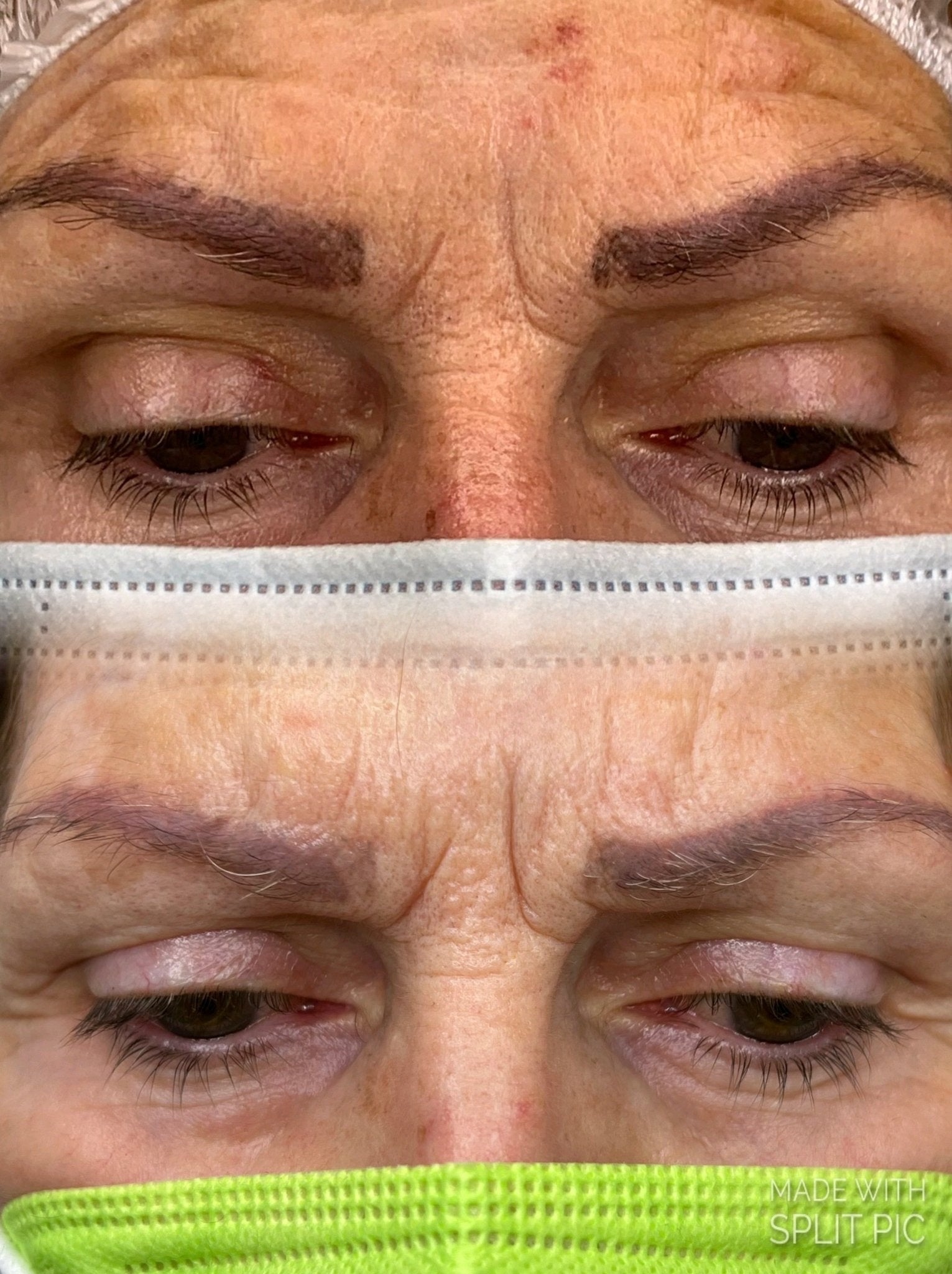 Corso online "Rimozione Trucco Permanente e Body Tattoo" KIT COMPRESO - Dermafusion