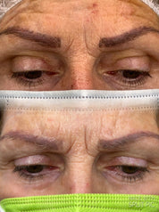 Corso online "Rimozione Trucco Permanente e Body Tattoo" KIT COMPRESO - Dermafusion