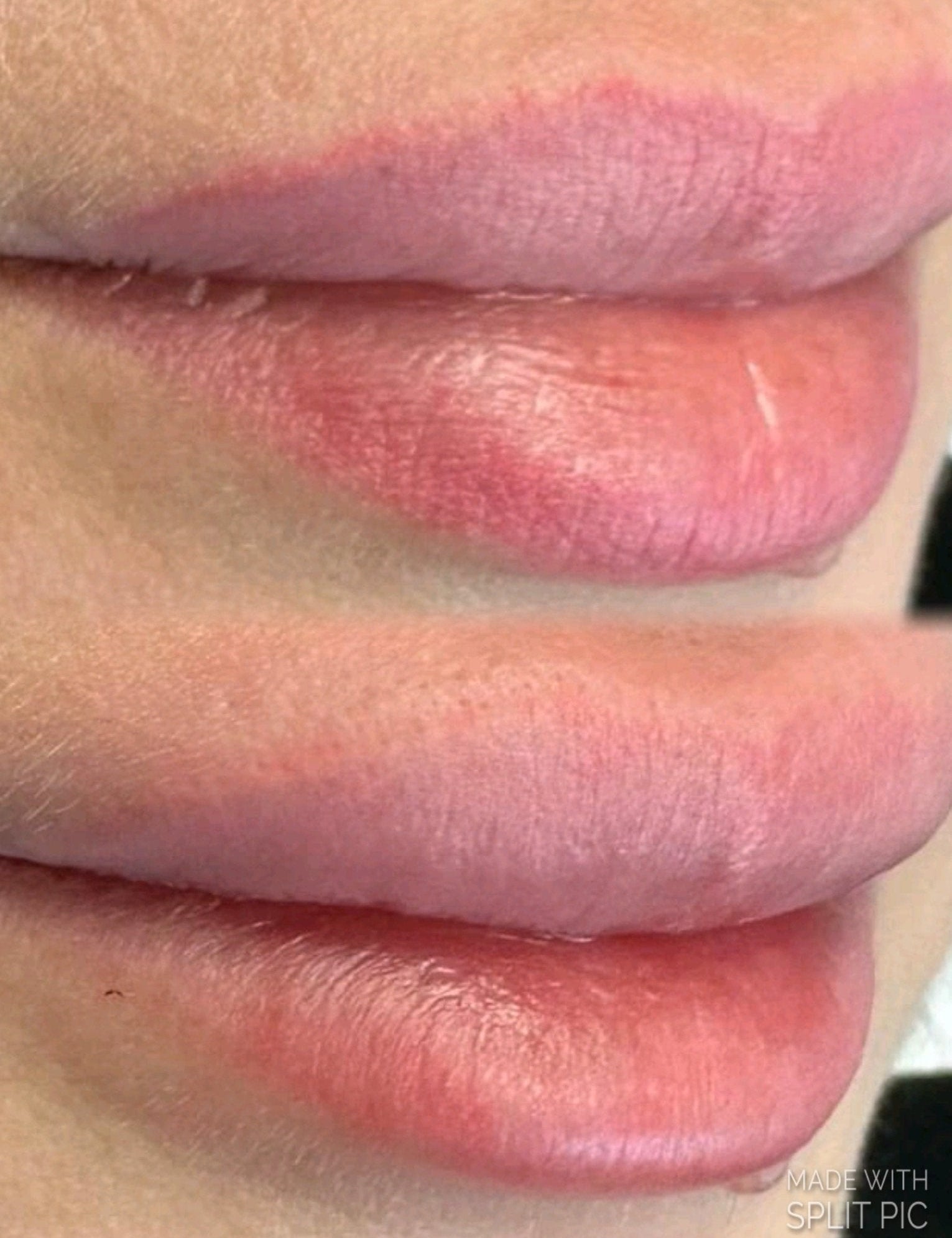 Corso online "Rimozione Trucco Permanente e Body Tattoo" KIT COMPRESO - Dermafusion