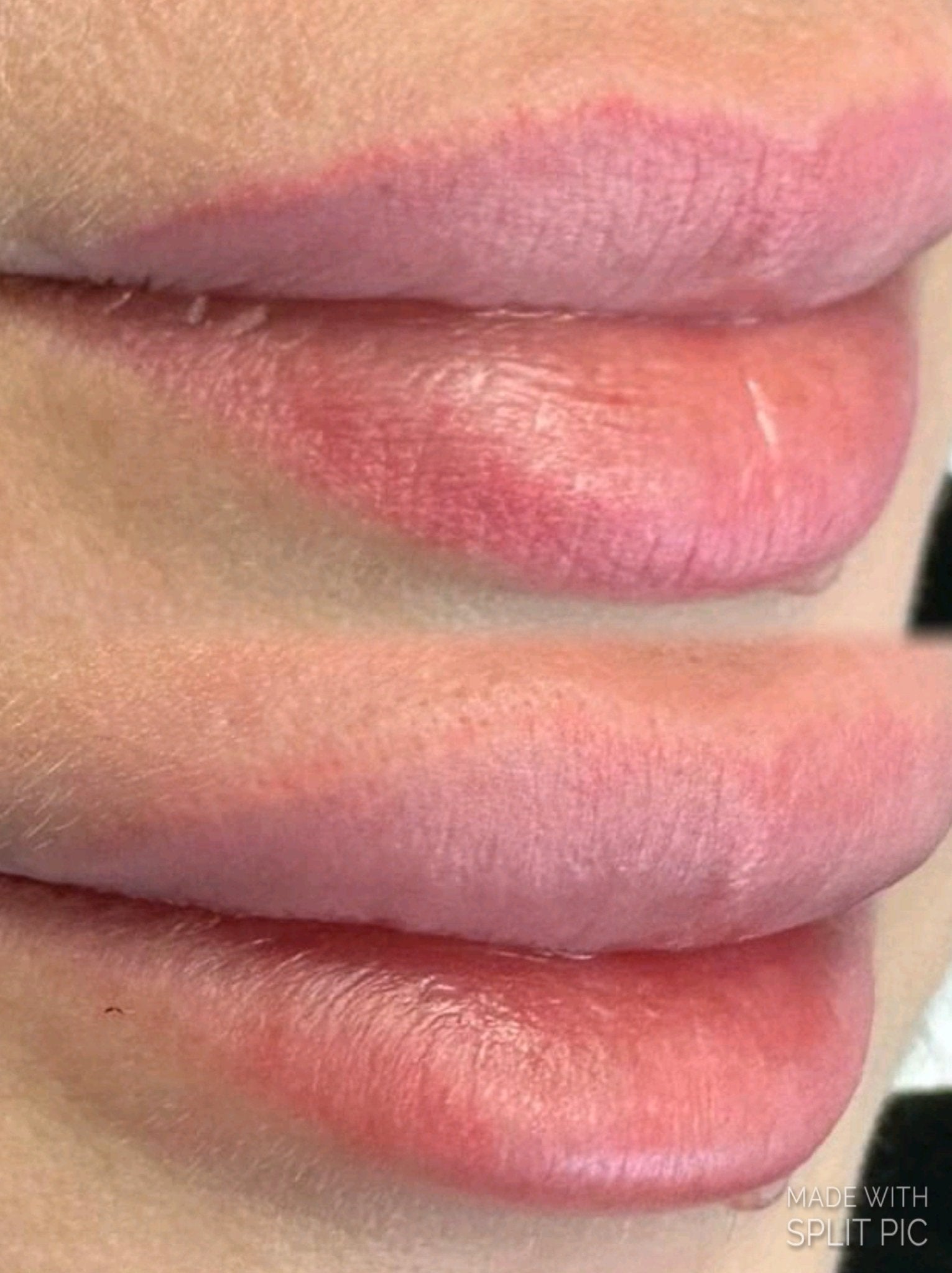 Corso online "Rimozione Trucco Permanente e Body Tattoo" KIT COMPRESO - Dermafusion